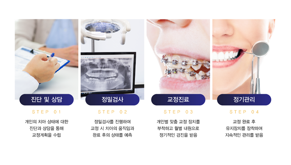루아치과 치아교정 과정